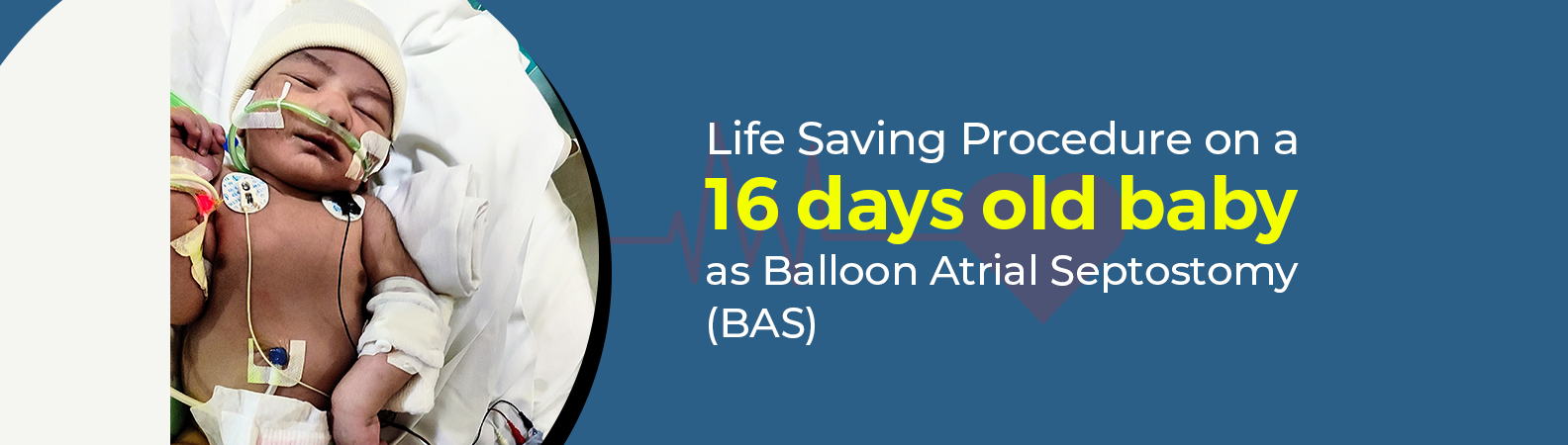 Life Saving Procedure - Balloon Atrial Septostomy
