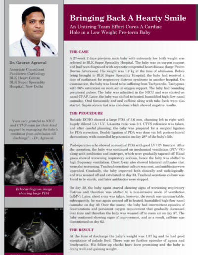 Media article featuring Dr. Gaurav Agrawal