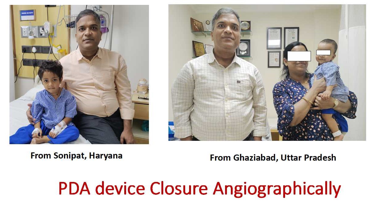 PDA Device Closure