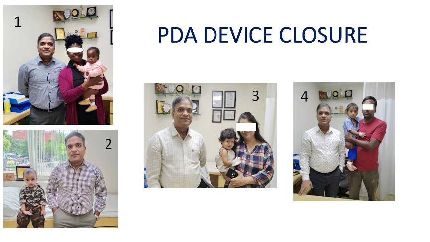 Multiple PDA Device Closures