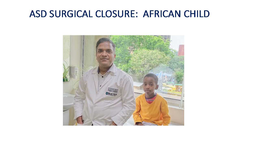 ASD Device Closure - African child