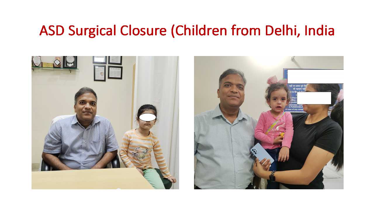 2. PDA (Patent Ductus Arteriosus) Device Closure (Angiographically without Heart Surgery)